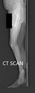 Preoperative CT scan topography images - img 2