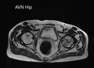 Axial sections of and T1WI