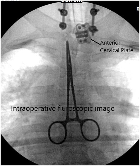 Imagen fluoroscópica intraoperatoria