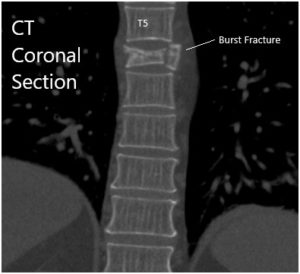 TC Secciones sagital y coronal 2