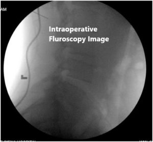 Imágenes fluoroscópicas intraoperatorias