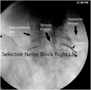 Imagen fluoroscópica intraoperatoria