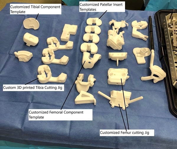 Customized knee replacement templates and