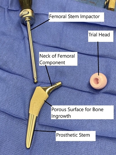 Total Hip Replacement Components.
