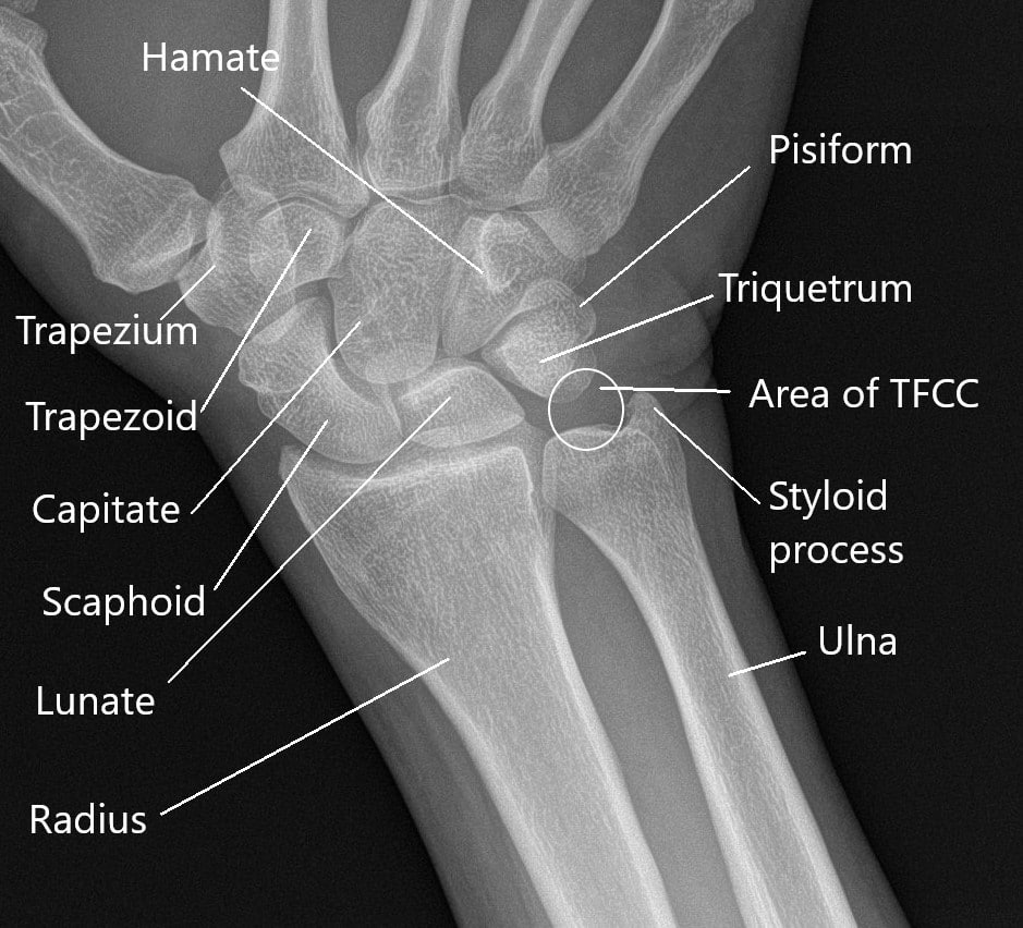 X-ray of the wrist showing anatomy of the wrist. X-ray of the wrist showing anatomy of the wrist.