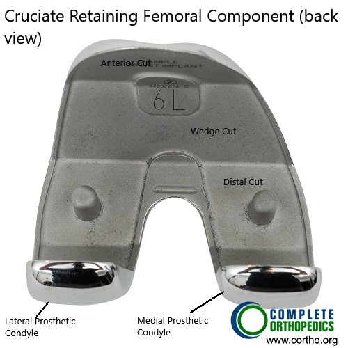 Cruciate retaining femoral component Cruciate retaining femoral component