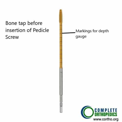Bone tap Bone tap