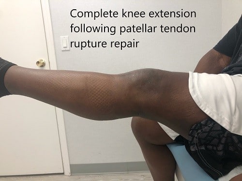 Postoperative images at 2 months follow up. Postoperative images at 2 months follow up.