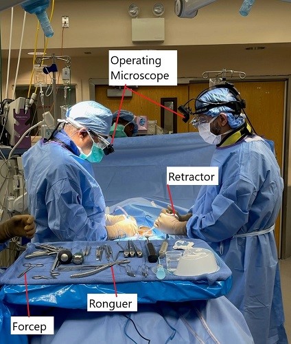 Imagen intraoperatoria de la cirugía de microdiscectomía lumbar. Imagen intraoperatoria de la cirugía de microdiscectomía lumbar.