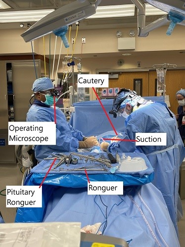 Imagen intraoperatoria que muestra la cirugía de microdiscectomía. Imagen intraoperatoria que muestra la cirugía de microdiscectomía.