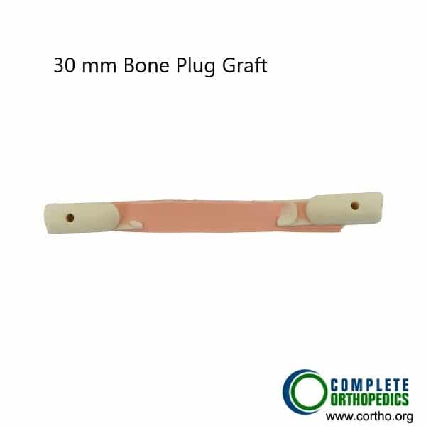 Bone plug graft used in ACL reconstruction. Bone plug graft used in ACL reconstruction.