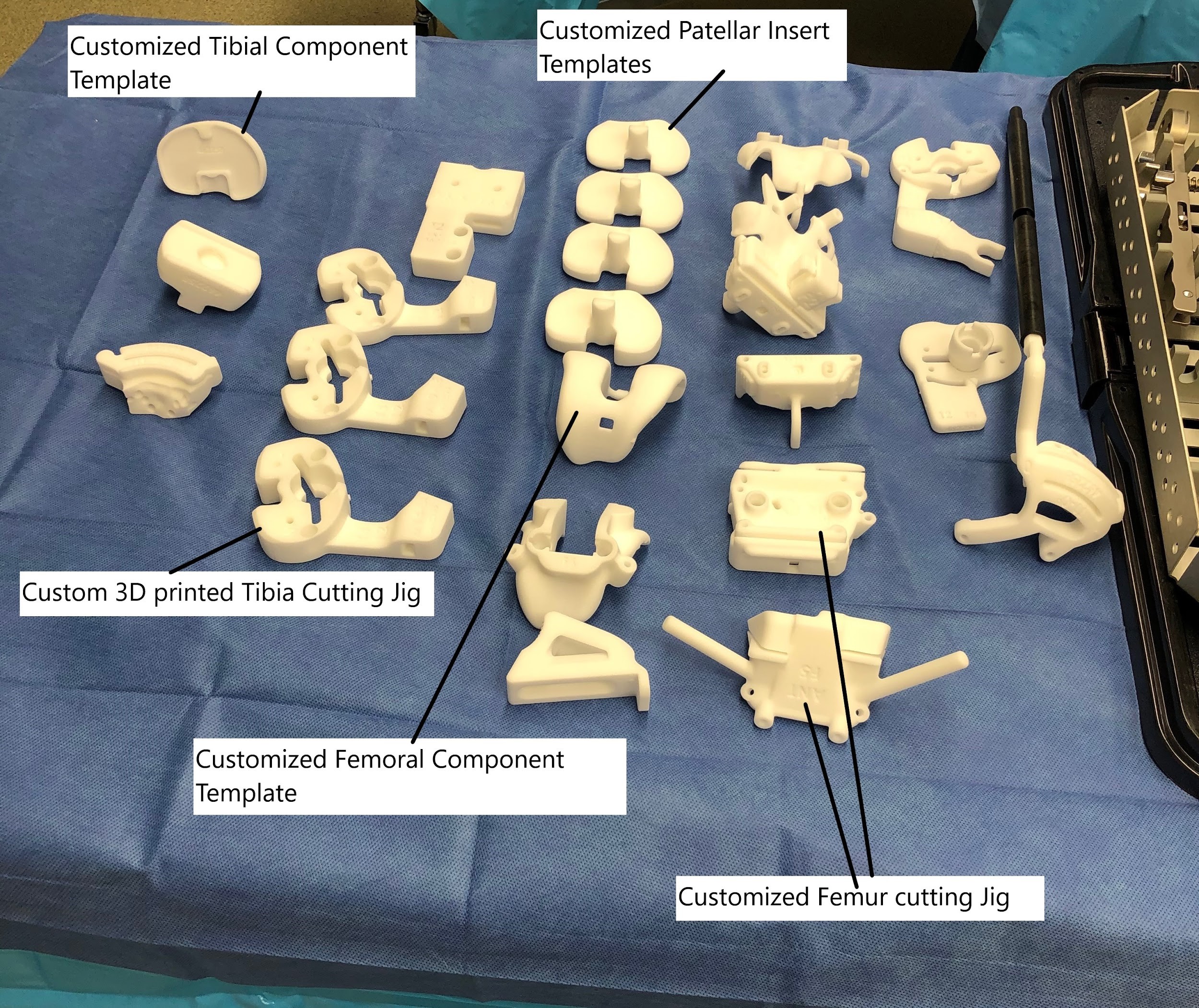 Custom 3D printed cutting blocks. Custom 3D printed cutting blocks.