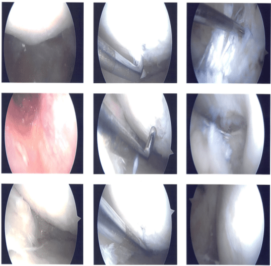 Imágenes intraoperatorias