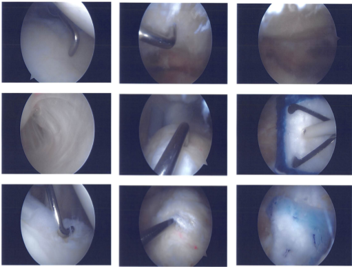 Clinical images