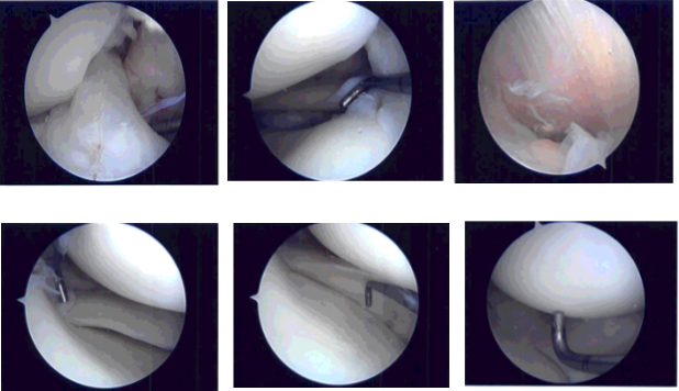 Intraoperative photo