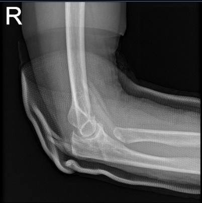 Right wrist x-ray 3 or more views
